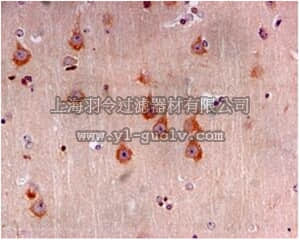 merck millipore,默克密理博,MABC756,Anti-MAP3K7, clone EPR5984, Rabbit Monoclonal Antibody