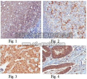 merck millipore,默克密理博,MABC95,Anti-S1PR2/EDG5 Antibody, clone 6E8.1