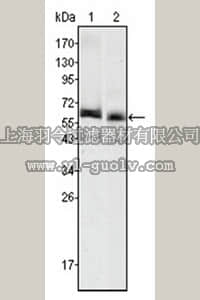 merck millipore,默克密理博,MABD170,Anti-AFP Antibody, clone 6E6