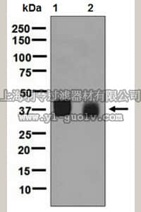 merck millipore,默克密理博,MABD177,Anti-Osteoglycin, clone EPR6963, Rabbit Monoclonal Antibody