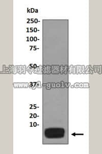 merck millipore,默克密理博,MABD182,Anti-Osteocalcin Antibody, clone EPR3690, rabbit monoclonal