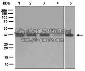 merck millipore,默克密理博,MABD183,Anti-RANKL, clone EPR4999, Rabbit Monoclonal Antibody