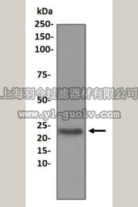 merck millipore,默克密理博,MABD184,Anti-Noggin Antibody, clone EPR1561, rabbit monoclonal