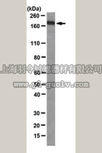 merck millipore,默克密理博,MABD34,Anti-Werner's syndrome helicase (WRN) Antibody, clone 20A11.1