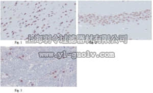 merck millipore,默克密理博,MABD50,Anti-MyT1L Antibody, clone 20B4.1