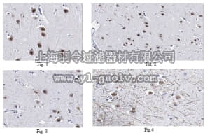merck millipore,默克密理博,MABD64,Anti-Achaete-scute homolog 1 Antibody, clone 6D8.1