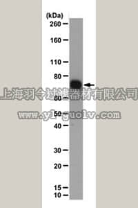 merck millipore,默克密理博,MABD85,Anti-LIMD1 Antibody, clone 3F2/C6