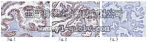 merck millipore,默克密理博,MABE142,Anti-Sirt6 Antibody, clone 6G2.2