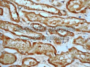 merck millipore,默克密理博,MABE202,Anti-MEF2A Antibody, clone EP1706Y, rabbit monoclonal