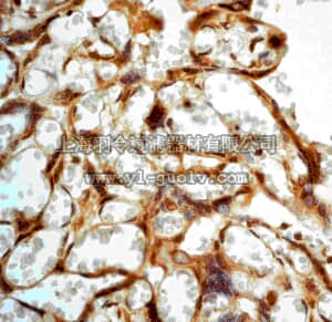 merck millipore,默克密理博,MABE204,Anti-HoxB4 Antibody, clone EP1919Y, rabbit monoclonal