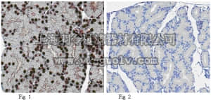 merck millipore,默克密理博,MABE227,Anti-FTO Antibody, clone 5-2H10