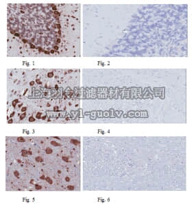 merck millipore,默克密理博,MABE268,Anti-Musashi-1 Antibody, clone 7B11.1