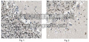 merck millipore,默克密理博,MABE361,Anti-TCF-4 Antibody, clone 5F9.1