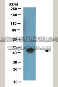 merck millipore,默克密理博,MABE365,Anti-acetyl PARP1 Antibody, clone E4
