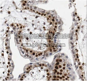 merck millipore,默克密理博,MABE421,Anti-Lymphoid-specific helicase (SMARCA6) Antibody, clone 2G7.1