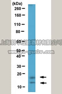 merck millipore,默克密理博,MABE445,Anti-phospho Ubiquitin-conjugating enzyme E2 A (Ser120) Antibody, clone 7E4