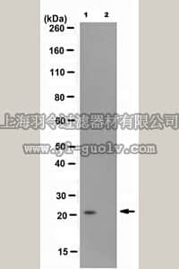 merck millipore,默克密理博,MABE453,Anti-monoubiquityl Histone H2B (Lys119) Antibody, clone 7B4