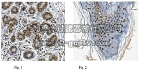 merck millipore,默克密理博,MABE455,Anti-CHD-4 Antibody, clone 3F2/4