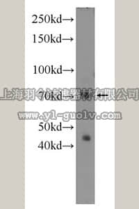 merck millipore,默克密理博,MABE465,Anti-FUS Antibody