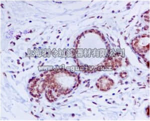 merck millipore,默克密理博,MABE481,Anti-Lamin A/C, clone EP4520, Rabbit Monoclonal Antibody