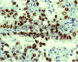 merck millipore,默克密理博,MABE513,Anti-TTF1, clone EPR5955(2), Rabbit Monoclonal Antibody