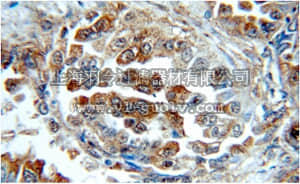 merck millipore,默克密理博,MABE567,Anti-RRM1, clone 60073-2 Antibody