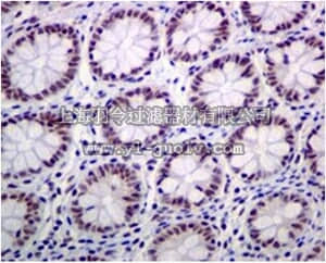 merck millipore,默克密理博,MABE584,Anti-phospho-SMC1 (Ser360), clone EPR4498(2), Rabbit Monoclonal Antibody