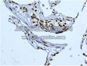 merck millipore,默克密理博,MABE585,Anti-SUN2, clone EPR6557, Rabbit Monoclonal Antibody