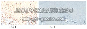 merck millipore,默克密理博,MABE78,Anti-MiTF Antibody, clone 3D1.2