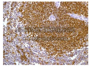 merck millipore,默克密理博,MABF193,Anti-CD32 Antibody, clone EP6243, rabbit monoclonal