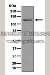 merck millipore,默克密理博,MABF198,Anti-MDA-5 Antibody, clone EPR6743, rabbit monoclonal