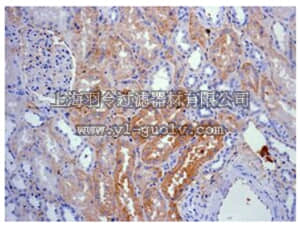 merck millipore,默克密理博,MABF202,Anti-Kininogen-1 Antibody, clone EPR6097, rabbit monoclonal