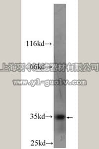 merck millipore,默克密理博,MABF207,Anti-CXCL16 Antibody, clone 60123-1