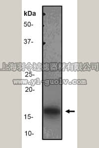merck millipore,默克密理博,MABF22,Anti-IL-1 Beta (CT) Antibody, clone EP408Y, rabbit monoclonal