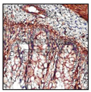 merck millipore,默克密理博,MABF23,Anti-Indian Hedgehog (IHH) (NT) Antibody, clone EP1192Y, rabbit monoclonal
