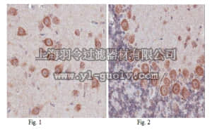 merck millipore,默克密理博,MABN101,Anti-Netrin receptor DCC Antibody, clone 2A11.1