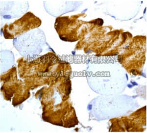 merck millipore,默克密理博,MABN1025,Anti-ATP2A1 Antibody, clone EPR7321, rabbit monoclonal