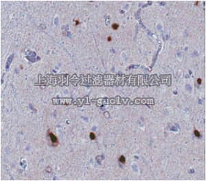 merck millipore,默克密理博,MABN102,Anti-ARX Antibody, clone 11F6.2