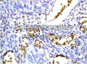 merck millipore,默克密理博,MABN1031,Anti-Hemoglobin Antibody delta chain, clone EPR8322(B), rabbit monoclonal