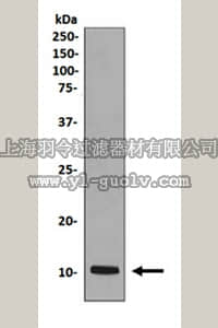 merck millipore,默克密理博,MABN1034,Anti-PPBP Antibody, clone EPR7766, rabbit monoclonal
