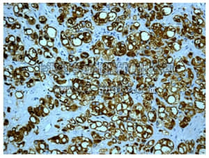 merck millipore,默克密理博,MABN1035,Anti-PSMA Antibody, clone EPR6253, rabbit monoclonal