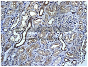 merck millipore,默克密理博,MABN1037,Anti-ROCK2 Antibody, clone EPR7141(B), rabbit monoclonal