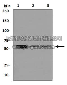 merck millipore,默克密理博,MABN1042,Anti-TXA2R Antibody, clone EPR7336, rabbit monoclonal