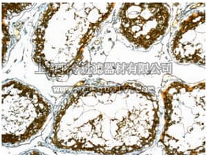 merck millipore,默克密理博,MABN1043,Anti-UCHL3 Antibody, clone EPR5332, rabbit monoclonal