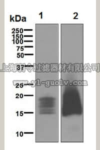 merck millipore,默克密理博,MABN1047,Anti-CD52 Antibody, clone EPR3153(2), rabbit monoclonal