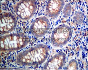 merck millipore,默克密理博,MABN1064,Anti-phospho eIF-4B (Ser406), clone EPR7683 Rabbit Monoclonal Antibody
