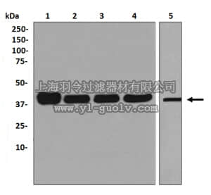 merck millipore,默克密理博,MABN1067,Anti-Folate Receptor Antibody 1, clone EPR4708(2), rabbit monoclonal