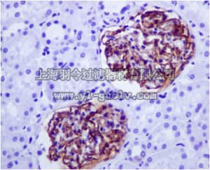 merck millipore,默克密理博,MABN1080,Anti-CD35, clone EPR6601, Rabbit Monoclonal Antibody