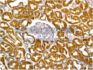 merck millipore,默克密理博,MABN1084,Anti-IL-12 alpha, clone EP5737, Rabbit Monoclonal Antibody