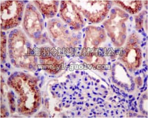 merck millipore,默克密理博,MABN1095,Anti-RBP4, clone EPR5879 Antibody